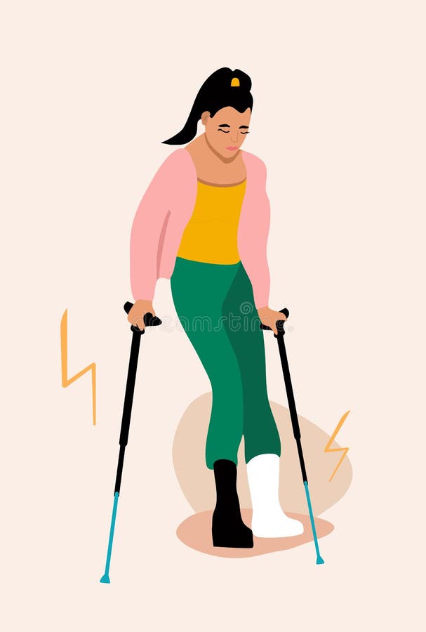 Ung kvinna med bruten benflicka med ortopedisk giv som går med hjälp av fraktur med ryggben eller sprein med gipsmissnöjd inj stock illustrationer