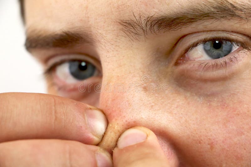 Ung man för Closeupstående som ser kameran och att pressa akne eller pormaskar på näsan Närbild som bakgrund för hygienen arkivfoton Ung man för Closeupstående som ser kameran och att pressa akne eller pormaskar på näsan Närbild som bakgrund för hygienen arkivfoton