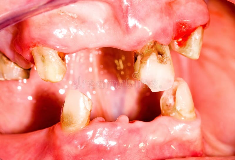 Unhealthy mouth stock image. Image of prosthetics, denture - 29420613