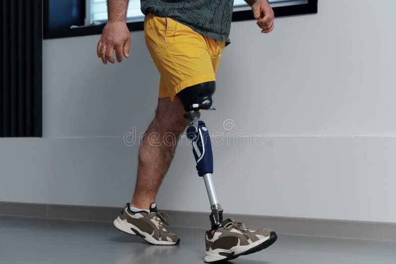 Unrecognisable Male in Yellow Coloured Shorts Wearing Prosthetic Leg ...