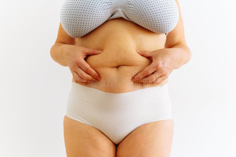 Overweight Woman Holding Her Belly. Turgor of Loose Skin is Lost. Stock  Image - Image of healthy, cell: 252549563