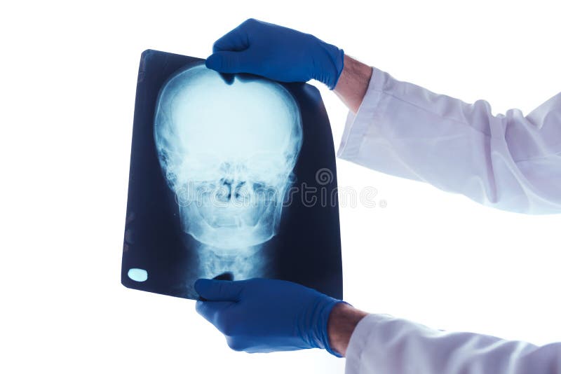 Untersuchungsröntgenstrahl Doktors des Schädels lizenzfreie stockbilder Untersuchungsröntgenstrahl Doktors des Schädels lizenzfreie stockbilder