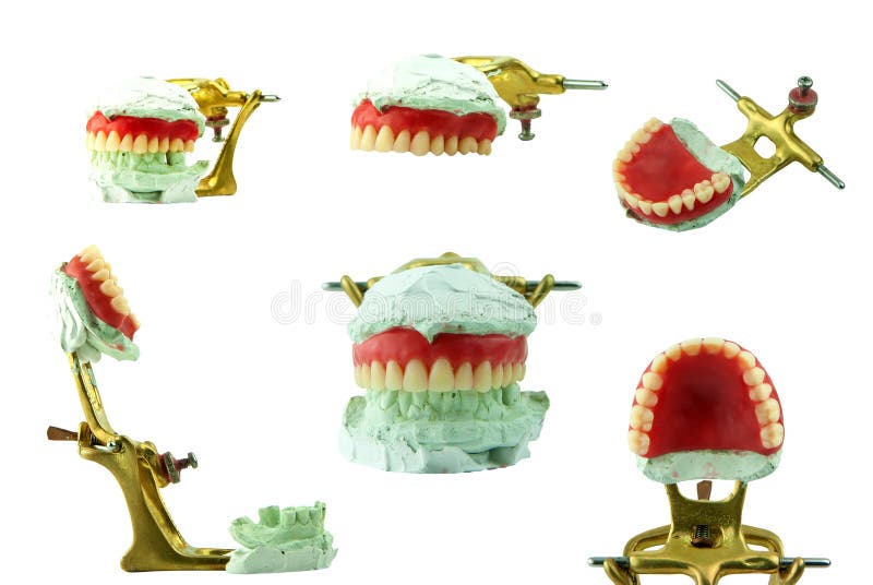 Upper Denture Wax Model with Jaw Stock Image Image of hygiene