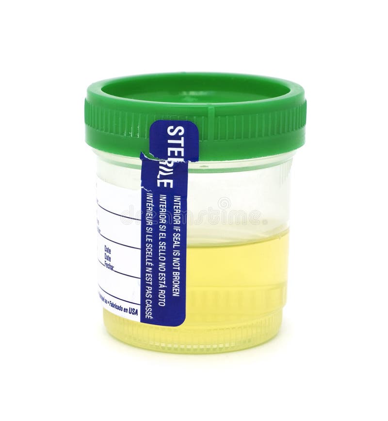 Urine in a container on a white background. Urine in a container on a white background.