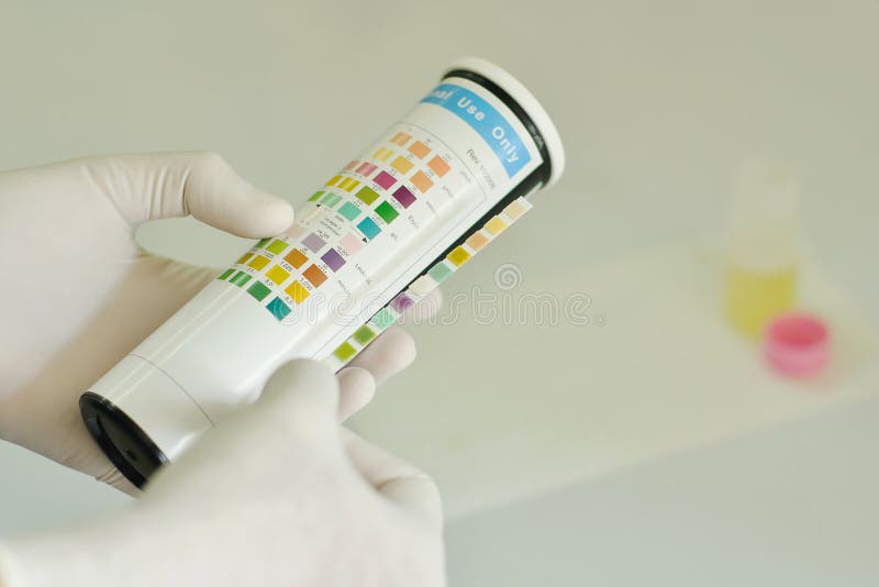 Urine analysis stock image. Image of chemistry, science 25306353
