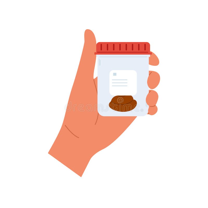 Urine analysis. Hand holds container with stool sample. Plastic containers with biomaterial stock illustration