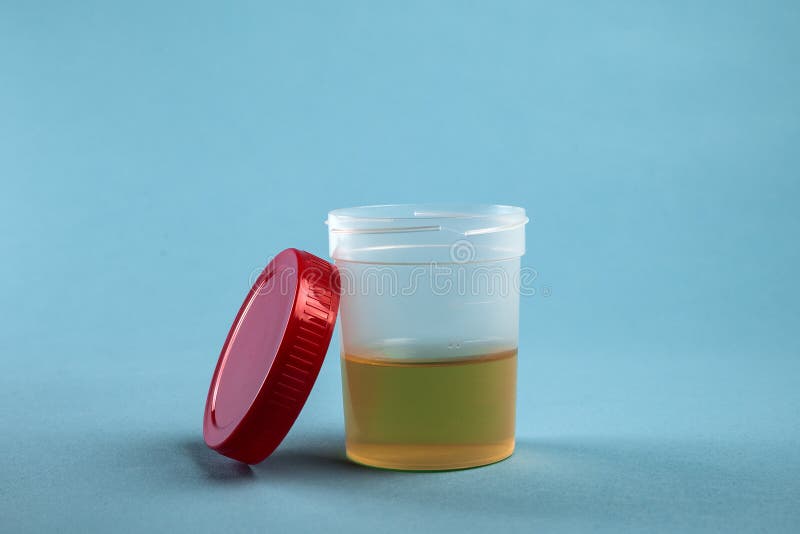 Urine Analysis for a Test in Plastic Jar Stock Photo Image of exam, container 179403194