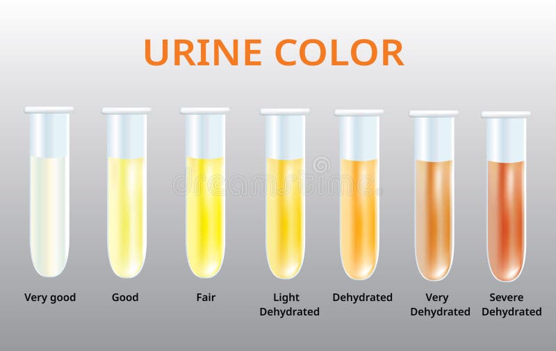 urine color chart 2 stock vector illustration of hematuria 106273889