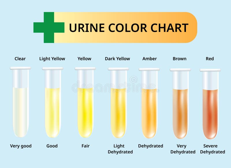 Baby Urine Color Chart