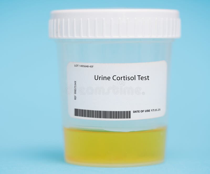 Urine Cortisol Test Stock Photo Image Of Monitor Test 277040646 cortisol-testing-how-to-collect-a-24-hour-urine-sample-youtube