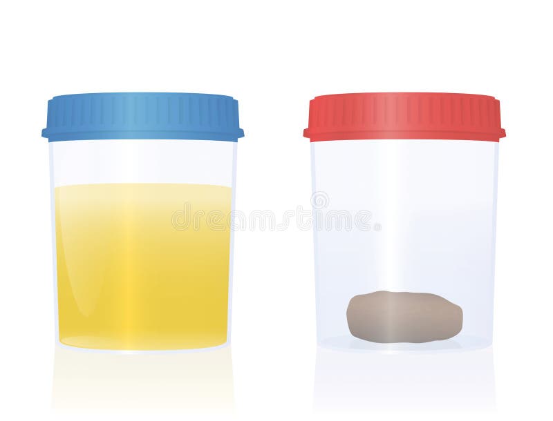 Urine Sample Fecal Specimen Stool Sample Cup Medical Examination vector illustration