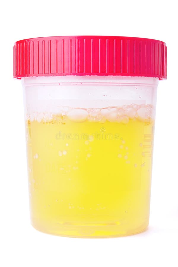 Urine Sample