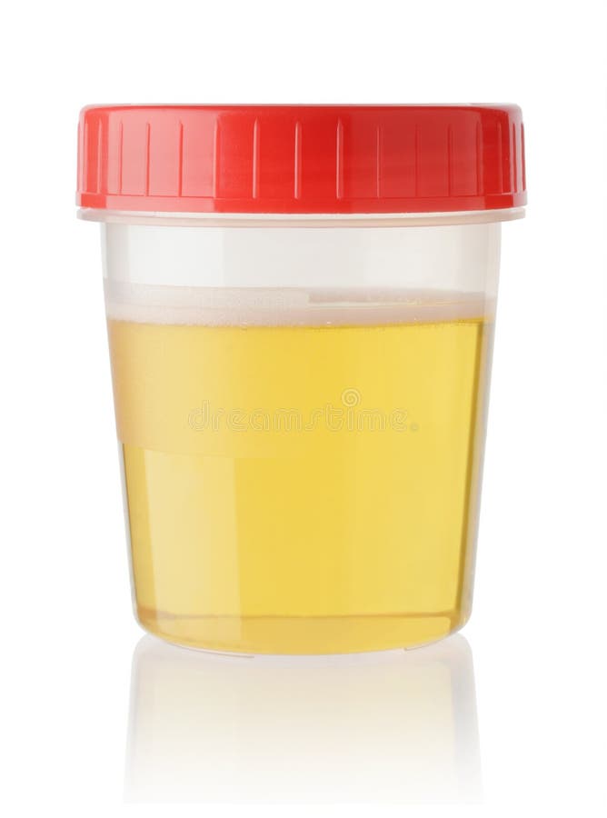 241 Human Urine Sample Bottle Stock Photos Free & RoyaltyFree Stock