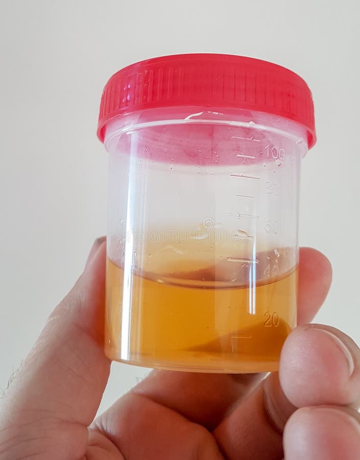 Urine Specimen Container Pee Cup Stock Image Image of urine, doctor