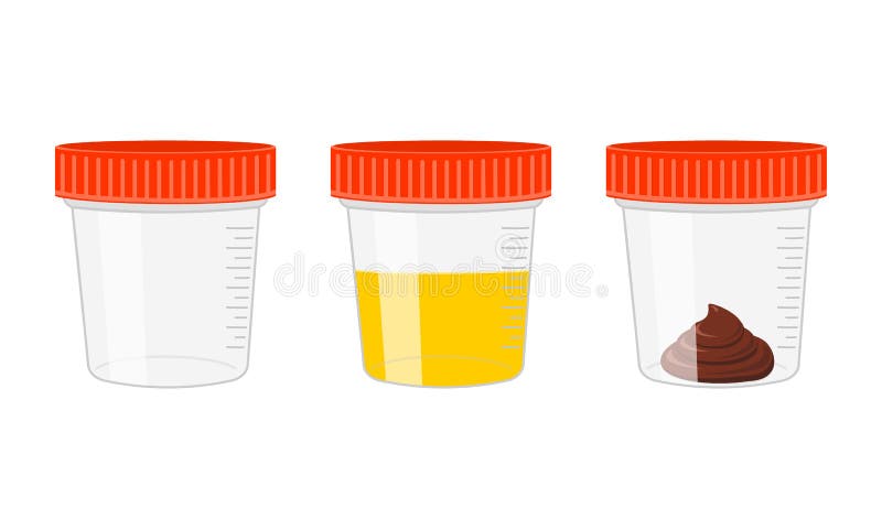 Urine and stool samples, empty and full plastic cups. Urinalysis, poo analysis set. Laboratory examination concept royalty free illustration