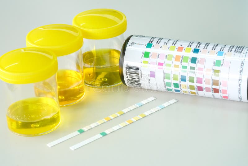 Urine strip test stock photo. Image of research, analysis 92189724