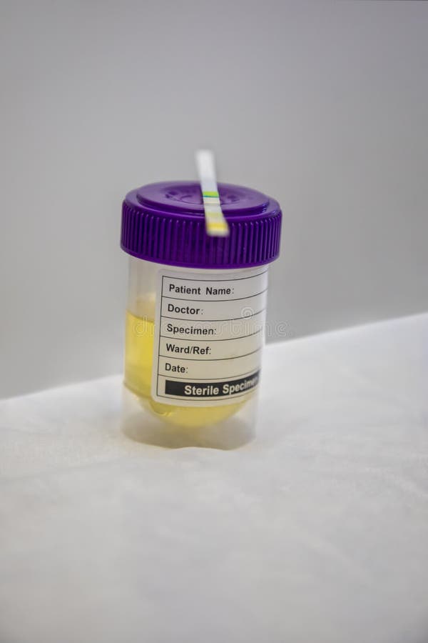 Urine sample stock image. Image of detect, analysis 198643107