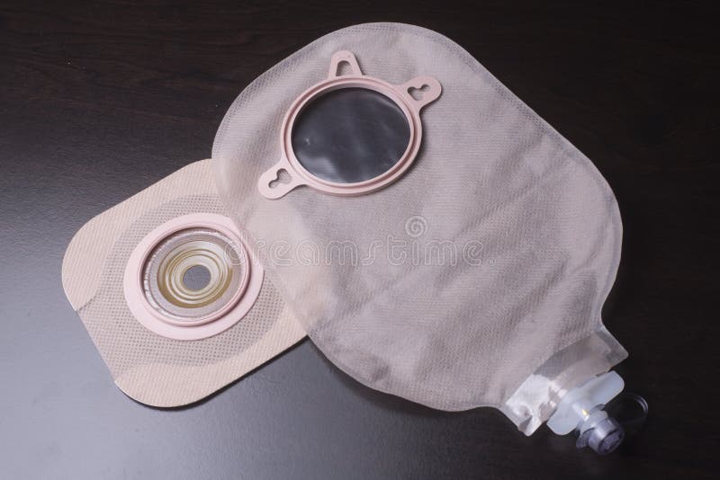 Urostomy pouch and wafer which works with a stoma for urine evacuation