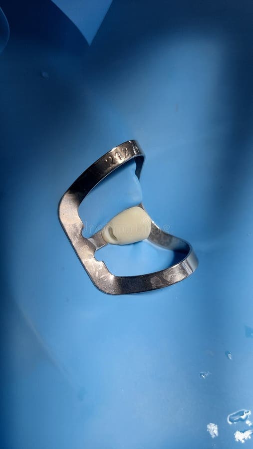 Use of rubber dam in canines with class V preparation cases