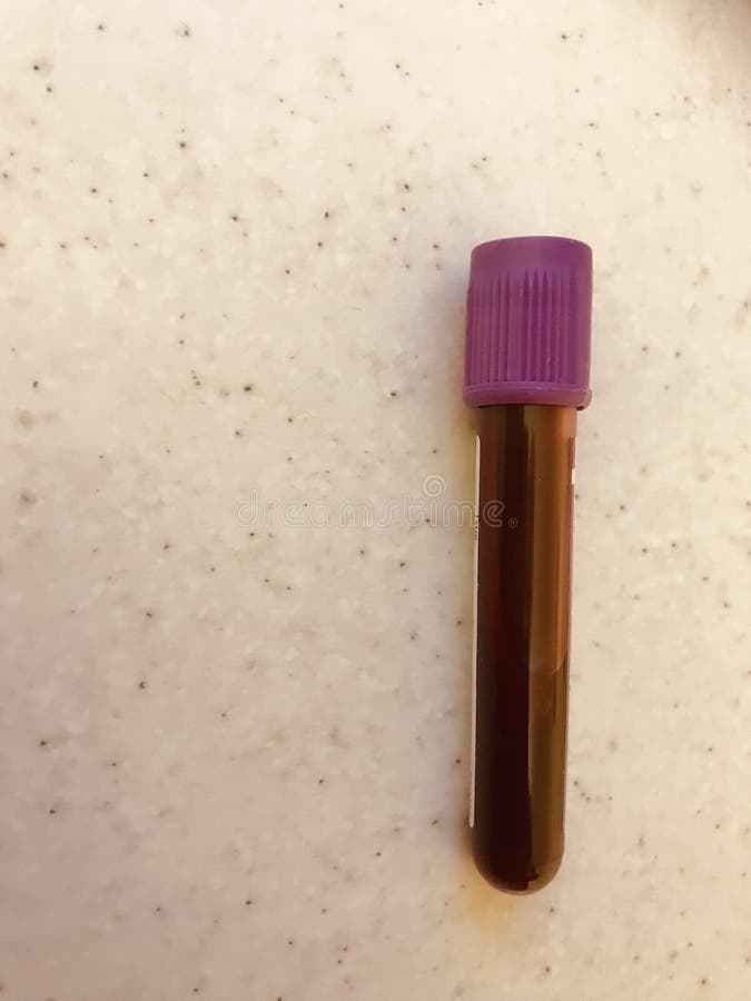 Lavender Top Blood Sample Edta Vacuum Tube Full Of Blood Stock Photo Image Of Form Laboratory