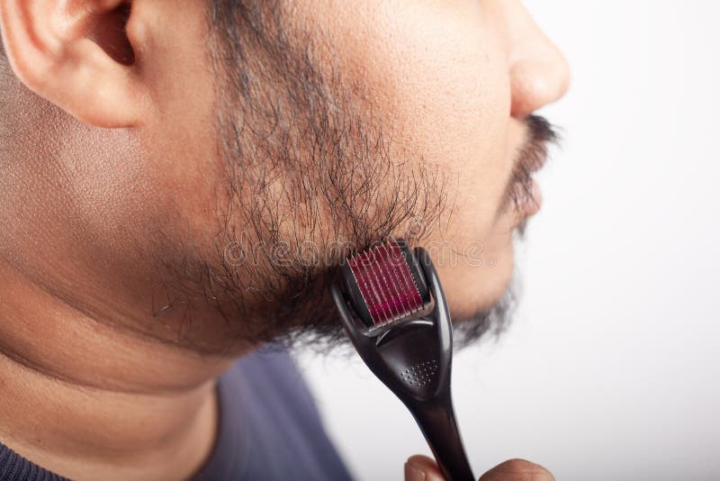 Using Microneedling or Collagen Induction Therapy for Beard Hair Growth  Stock Photo - Image of hair, closeup: 241780744