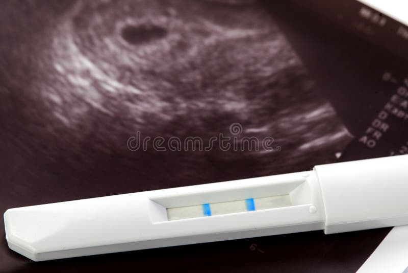 Utero della madre di ultrasuono e del test di gravidanza immagini stock libere da diritti Utero della madre di ultrasuono e del test di gravidanza immagini stock libere da diritti
