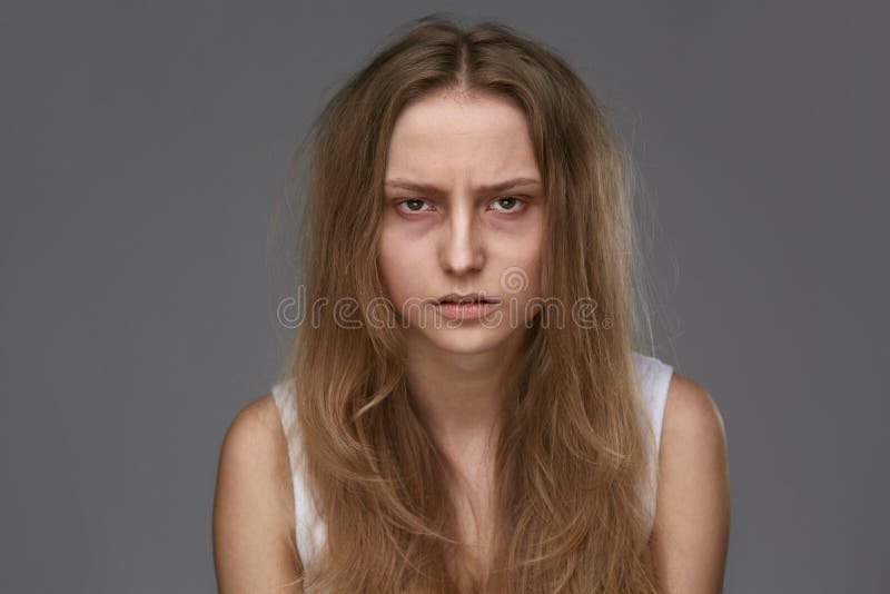 Exhausted Young Woman With Dark Circles And Bags, Bruises Under Eyes And Long Brittle Hair. High Resolution. Exhausted Young Woman With Dark Circles And Bags, Bruises Under Eyes And Long Brittle Hair. High Resolution.