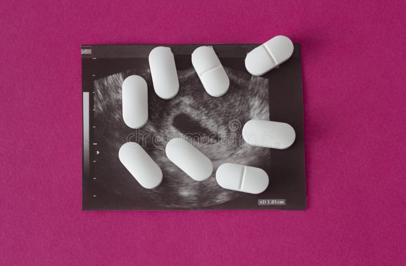 Uzi del embarazo en un fondo rosado y píldoras, aborto foto de archivo Uzi del embarazo en un fondo rosado y píldoras, aborto foto de archivo