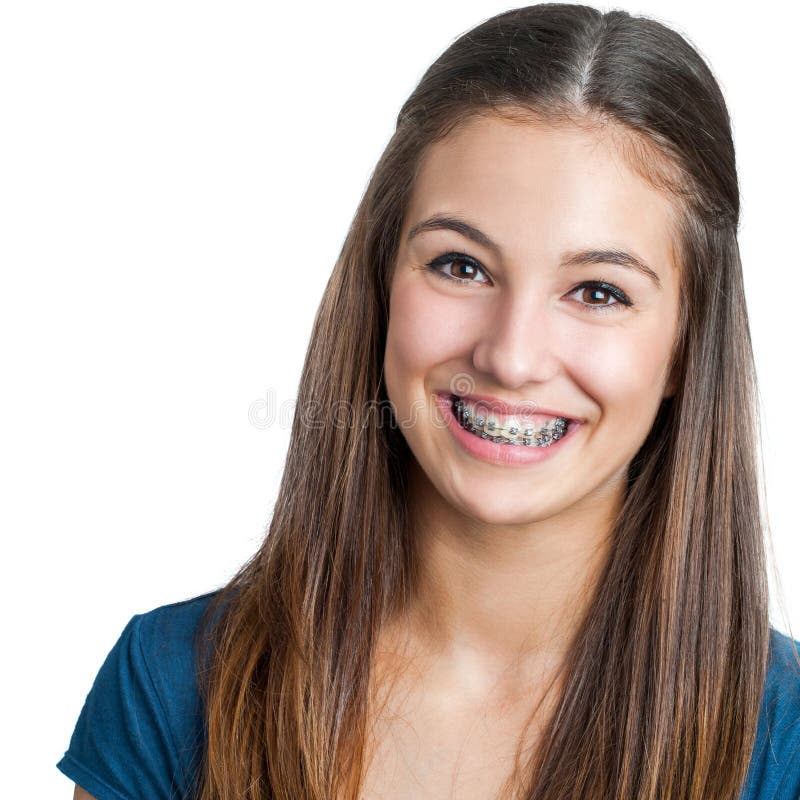 Uśmiechnięta Nastoletnia dziewczyna pokazuje stomatologicznych brasy