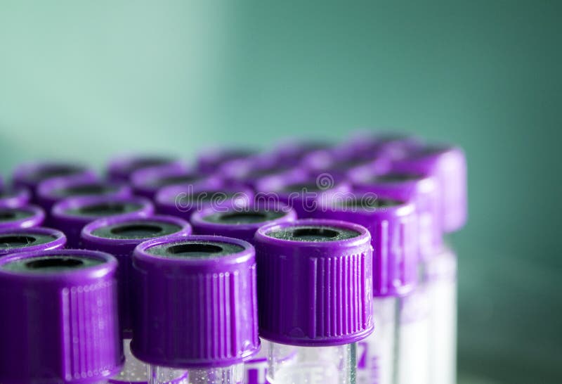 Vacuum Tubes for Blood Analysis Stock Image Image of sample, medicine
