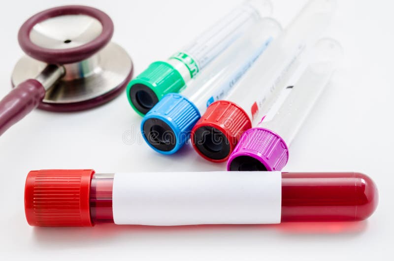 Vacuum tubes for collecting and blood samples. royalty free stock photography Vacuum tubes for collecting and blood samples. royalty free stock photography