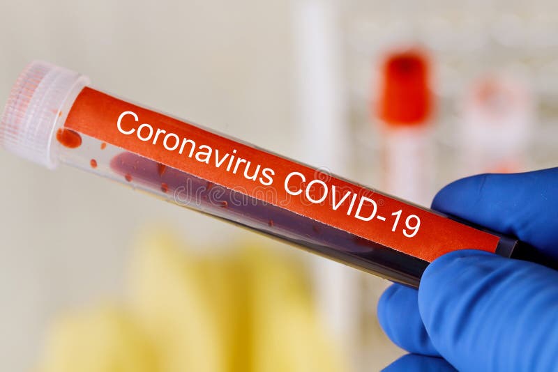 Vacuümbuizen coronavirus COVID-19 voor medisch gebruik met bloedmonster in een laboratorium royalty-vrije stock afbeelding Vacuümbuizen coronavirus COVID-19 voor medisch gebruik met bloedmonster in een laboratorium royalty-vrije stock afbeelding