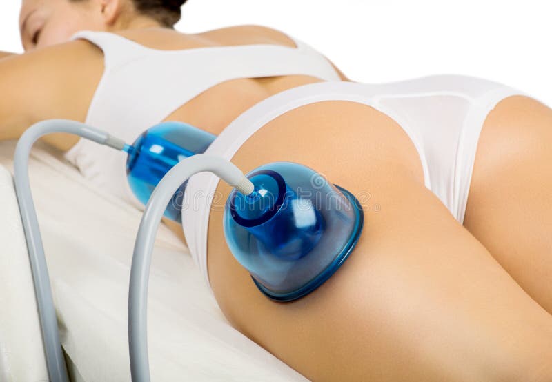 Vacuümvermageringsdieetmassage stock foto Vacuümvermageringsdieetmassage stock foto