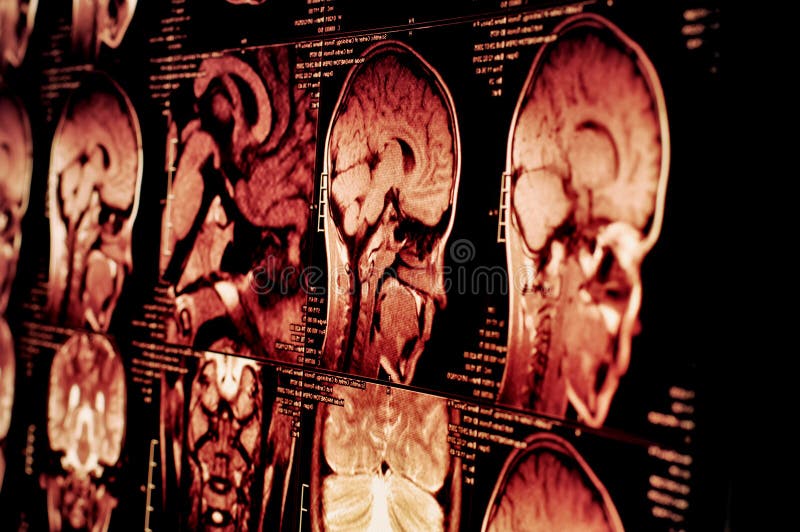Vage achtergrond Magnetic resonance imaging Conceptenalgemeen medisch onderzoek stock foto Vage achtergrond Magnetic resonance imaging Conceptenalgemeen medisch onderzoek stock foto