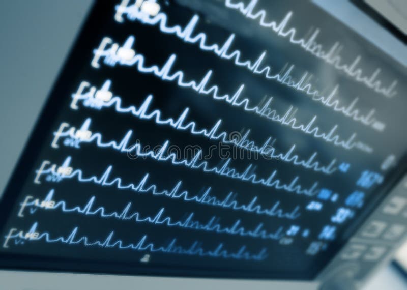 De Monitor Van Het Ziekenhuis Stock Afbeelding Image of herstelling