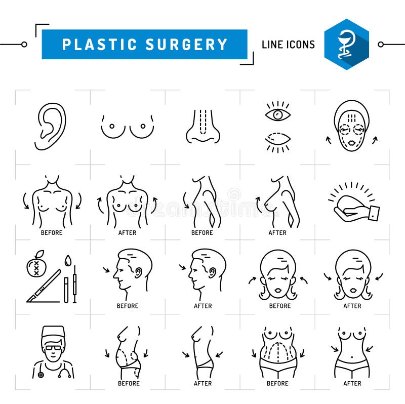 Van de lijnpictogrammen van het plastische chirurgieconcept de Zwarte dunne Vector Medische symbolen stock illustratie Van de lijnpictogrammen van het plastische chirurgieconcept de Zwarte dunne Vector Medische symbolen stock illustratie