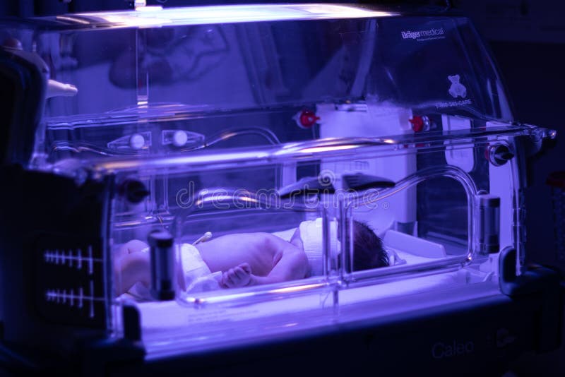 Newborn baby under ultraviolet lamp is getting treated for jaundice elevated bilirubin in Vancouver hospital