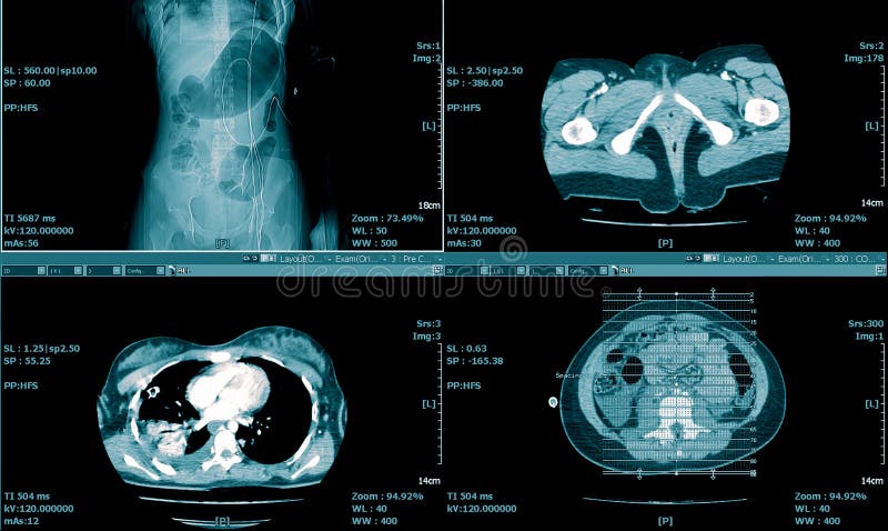 Varredura do CT do fundo médico da caixa fotografia de stock Varredura do CT do fundo médico da caixa fotografia de stock