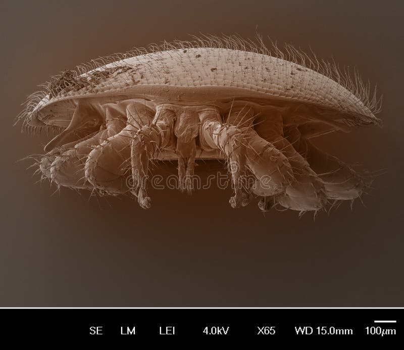 Varroa destructor bee parasite - an electron scanning microscope photo - Magnification 55x