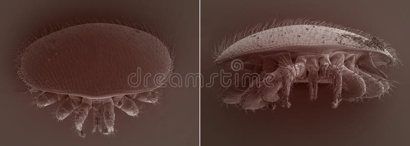 Varroa destructor bee parasite - an electron scanning microscope photo