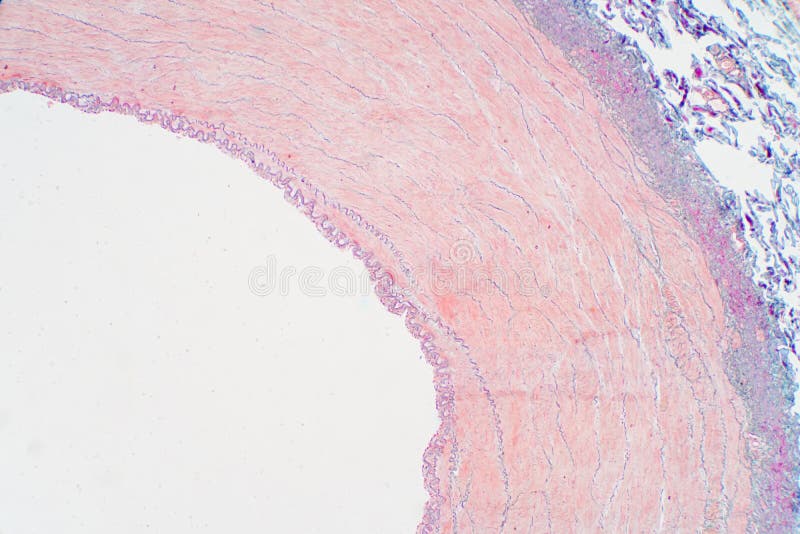 Срез сосуда. Кровеносные сосуды под микроскопом. Кровеносные капилляры под микроскопом. Артерия и Вена под микроскопом.