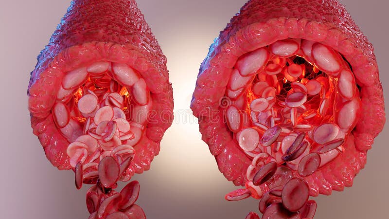 Vasocostrizione e vasodilazione pressione sanguigna dilatata vasi sanguigni o capillari o arteria immagine stock