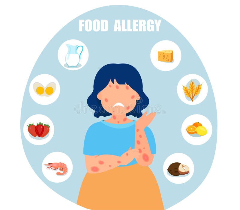 Vector of a Child with Skin Rash, Food Allergy Stock Vector ...