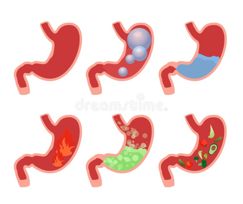 Gas Problem Stomach Stock Illustrations – 730 Gas Problem Stomach Stock  Illustrations, Vectors & Clipart - Dreamstime