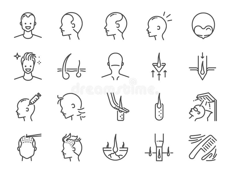 Transplant Hair Stock Illustrations – 1,524 Transplant Hair Stock Illustrations, Vectors & Clipart - Dreamstime Transplant Hair Stock Illustrations – 1,524 Transplant Hair Stock Illustrations, Vectors & Clipart - Dreamstime