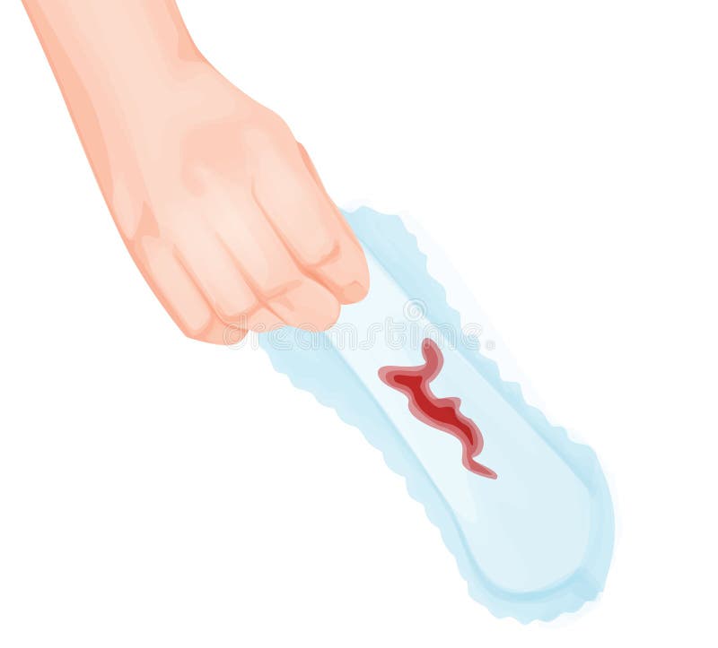 Vaginal Discharge Stock Illustrations – 58 Vaginal Discharge Stock Illustrations, Vectors & Clipart - Dreamstime