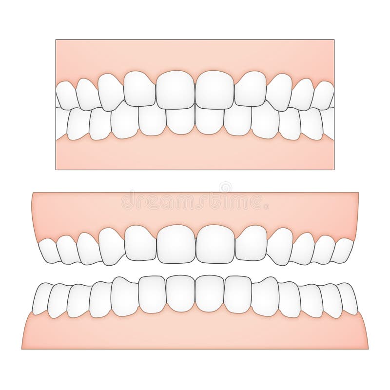 Vector illustration of white teeth and gums from a frontal perspective for medical and dental depictions royalty free illustration Vector illustration of white teeth and gums from a frontal perspective for medical and dental depictions royalty free illustration