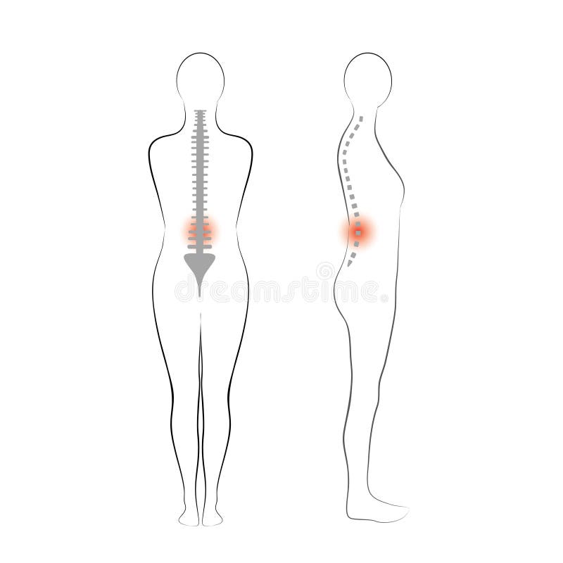 Vector woman body shape. Vertebrae pain. royalty free illustration Vector woman body shape. Vertebrae pain. royalty free illustration