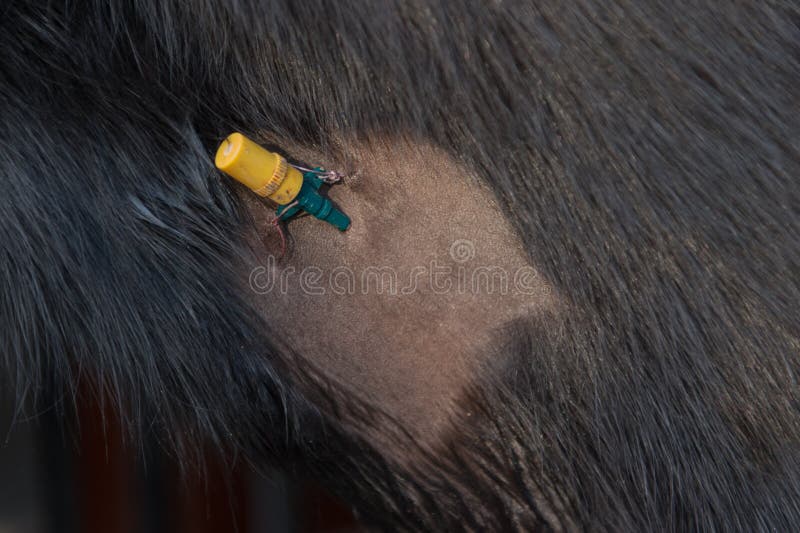 4,457 Catheter Photos Free & RoyaltyFree Stock Photos from Dreamstime