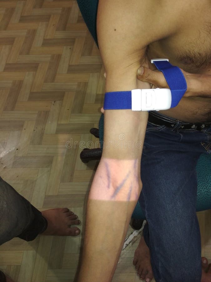 Venas de la palma, del brazo y del antebrazo por el buscador infrarrojo de la vena imágenes de archivo libres de regalías Venas de la palma, del brazo y del antebrazo por el buscador infrarrojo de la vena imágenes de archivo libres de regalías
